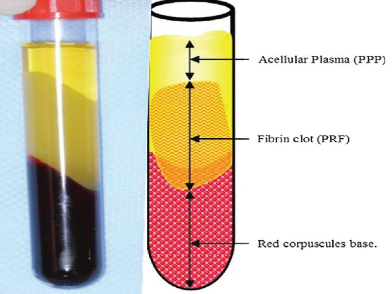 Person developing a website on a laptop